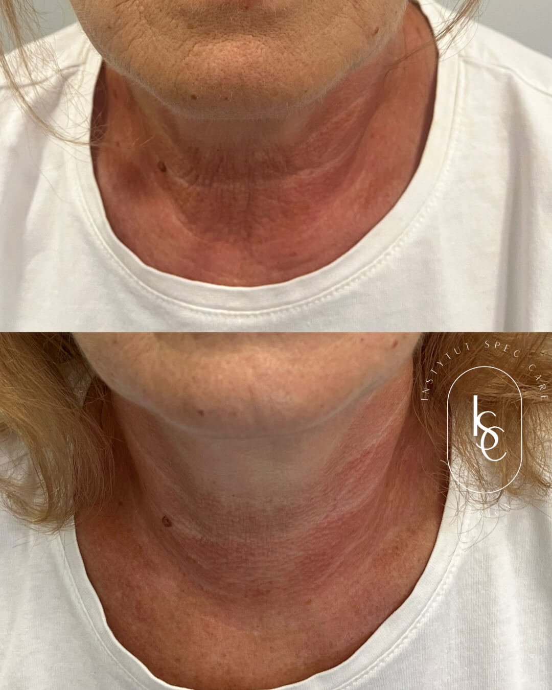 Efekt przed i po. Kosmetolog Dębica