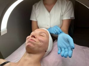 Terapia przebarwień Dębica